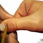 The Total Cells and Nerves Therapy